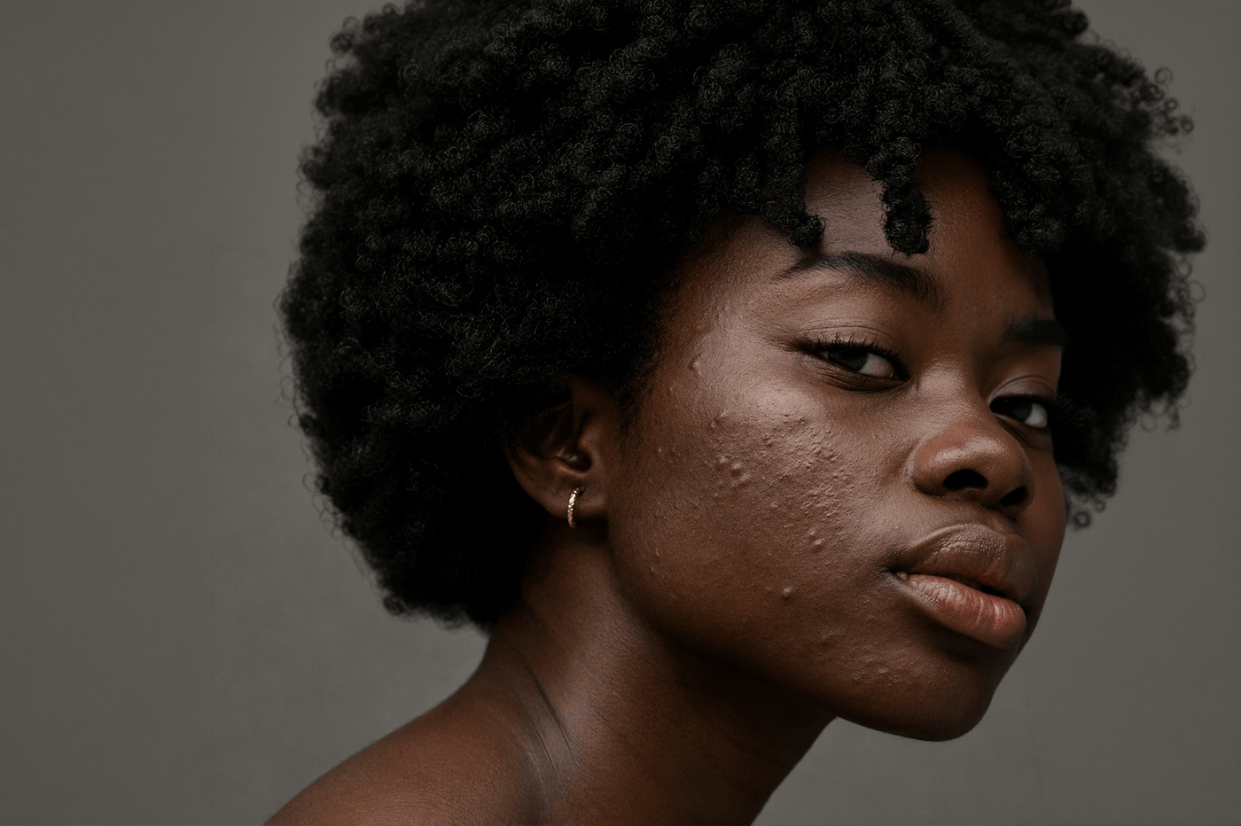 Close-up editorial portrait of a woman with visible acne, natural skin texture, and unretouched complexion. Soft lighting reveals authentic detail and celebrates real skin with confidence, honesty, and understated beauty.